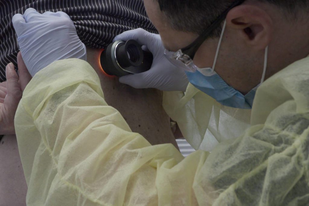 Dr Ben examining a patients back with a dermatoscope.